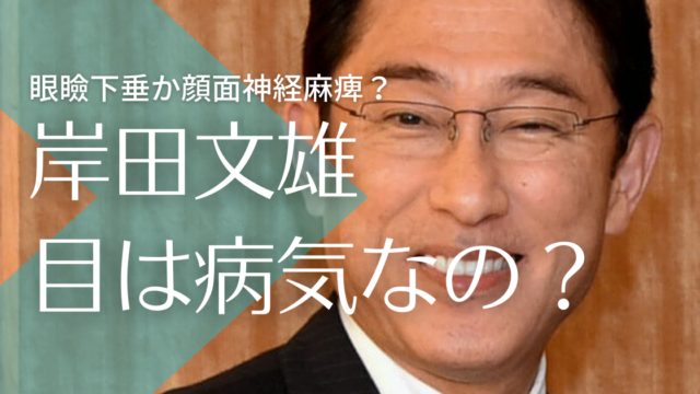 岸田文雄の左の目つきおかしいのは病気 義眼で眼瞼下垂 顔面麻痺の噂も トレンドマガジン