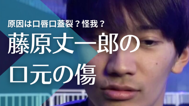 画像 藤原丈一郎の口元の傷は口唇口蓋裂ではなく怪我 いつからか確認 トレンドマガジン
