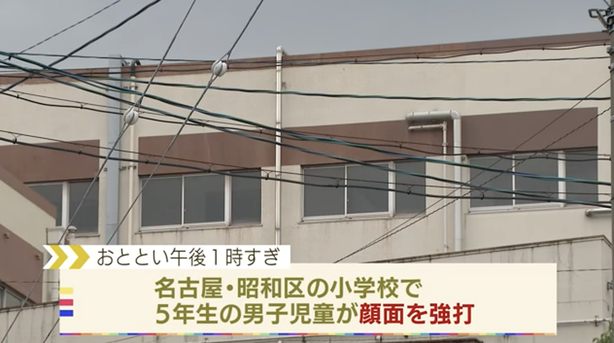 名古屋市内の小学校で児童が顔面骨折する大怪我を負う